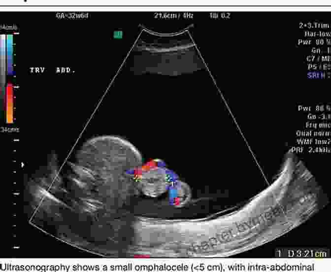 Callen Ultrasonography Reveals The Intricacies Of Fetal Development Callen S Ultrasonography In Obstetrics And Gynecology