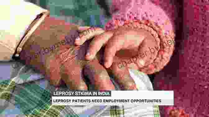 Social Consequences Of Leprosy Stigma Carville S Cure: Leprosy Stigma And The Fight For Justice